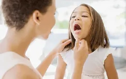 Biến chứng nguy hiểm của viêm họng khi thời tiết giao mùa