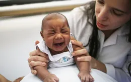 Tỷ lệ trẻ sơ sinh mắc dị tật bẩm sinh do virus Zika cao tại Mỹ