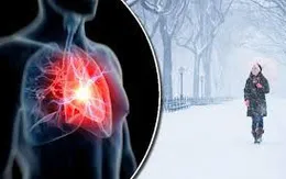 Bệnh đột quỵ gia tăng khi trời lạnh - dấu hiệu nhận biết và thời gian vàng điều trị