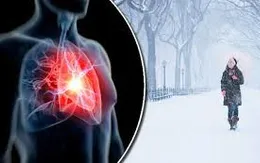 Thời tiết lạnh: gia tăng nguy cơ đột quỵ não