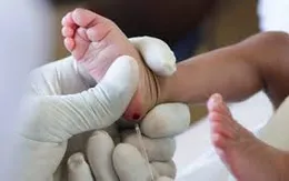Kỹ thuật xét nghiệm sinh học phân tử chẩn đoán sớm HIV cho trẻ dưới 18 tháng tuổi