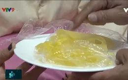 Nâng ngực làm đẹp: Không có “bảo hành trọn đời”