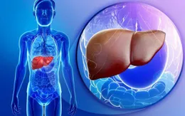 Điểm danh những tác nhân gây ung thư gan