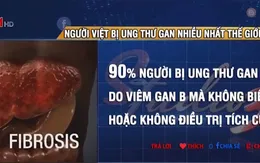 Người Việt bị ung thư gan nhiều nhất thế giới