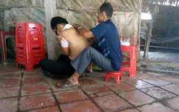 Nam thanh niên liệt hai chân vì "cắt lễ" trị đau lưng