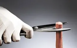 Có thể tự cắt bao quy đầu tại nhà?