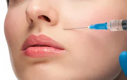 Tiêm filler làm đẹp thế nào cho an toàn?