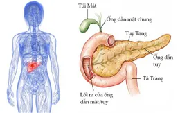 Ung thư tuyến tụy nguy hiểm mức độ nào?