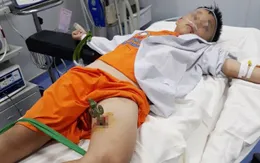 Ngã cành cây, bé trai 9 tuổi bị thanh sắt đâm thủng đùi