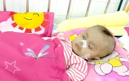 Giành sự sống cho bệnh nhi hẹp khí quản kèm sửa dị tật tim bẩm sinh