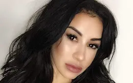 Mỹ: Một phụ nữ sống thực vật vì thẩm mỹ viện
