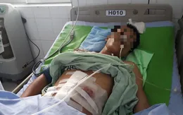 Người đàn ông nhập viện vì súng cướp cò bắn vào bụng