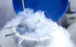 Bảo quản và trữ lạnh tinh trùng
