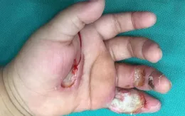 Bé 1 tuổi bị điện giật hôn mê do nghịch máy bơm nước
