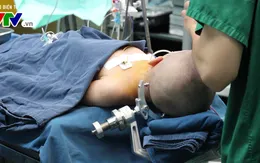 Hồi sinh cuộc sống cho 5 bệnh nhi động kinh kháng thuốc