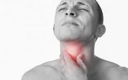 Viêm thanh quản cấp - đừng chủ quan