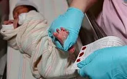 Sàng lọc trước sinh và sơ sinh: Tránh hậu quả nặng nề do dị tật
