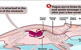 Thiết bị phát tín hiệu báo - giải pháp điều trị cho chứng béo phì