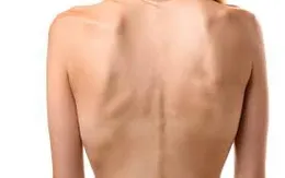 Gầy quá khó mang thai