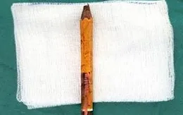 Bạn trêu đùa, bé trai bị bút chì đâm sâu vào mông