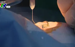 100 suất mổ mắt miễn phí tại TP. Hồ Chí Minh