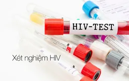 Bàn giao xe hỗ trợ xét nghiệm  HIV/AIDS lưu động cho 12 tỉnh