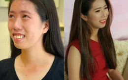 Cô gái nghèo và hành trình lấy lại nhan sắc