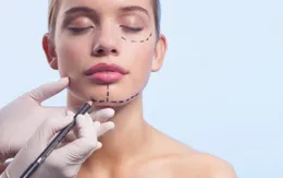 4 lời khuyên để có ca phẫu thuật thẩm mỹ an toàn