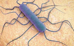 WHO cảnh báo nguy cơ lây lan vi khuẩn Listeria