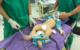 Điều trị lồng ruột cấp ở trẻ em