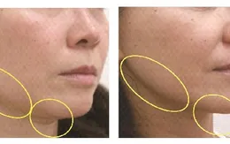 Công nghệ mới lưu giữ tuổi thanh xuân