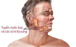 Các bệnh của tuyến nước bọt có nguy hiểm?