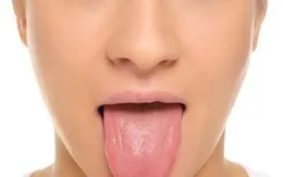 Nguyên nhân không ngờ gây ngứa lưỡi