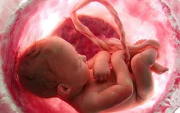 Thêm một thai nhi tử vong, Bộ Y tế tiếp tục yêu cầu làm rõ nguyên nhân