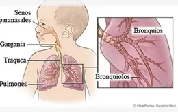 Trẻ bị viêm phổi xử trí thế nào?