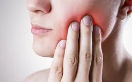 5 lý do cần quan tâm tới ung thư khoang miệng
