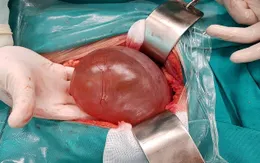 Mắc bệnh hiếm với các triệu chứng như bệnh dạ dày