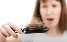 Những dấu hiệu mất cân bằng hoóc môn ở nữ giới