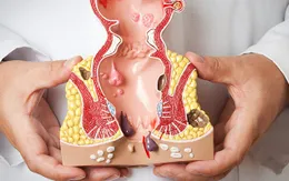 Những đối tượng nào dễ mắc ung thư hậu môn?