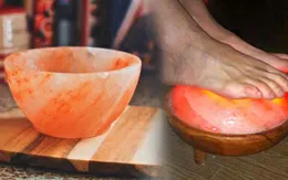 Giật mình: Sưởi đèn đá muối, bệnh nhân tiểu đường bị lột da chân, hoại tử