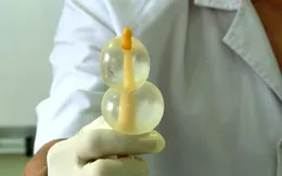 Kỹ thuật mới giúp giảm tỷ lệ sinh mổ