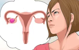 Thấy những dấu hiệu này, bạn hãy nghĩ ngay đến ung thư buồng trứng