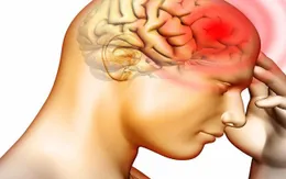 5 bước giúp phòng ung thư não hiệu quả