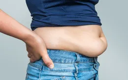 Bụng mỡ cũng gây nguy cơ mắc bệnh tim cao