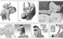 Xử trí và đề phòng hóc dị vật đường thở