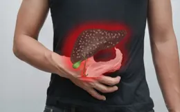 6 triệu chứng ung thư gan ai cũng cần phải biết