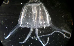 Bé gái bị loài sứa độc nhất thế giới cắn nhập viện cấp cứu