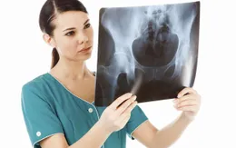 Mức độ lo lắng và việc gãy xương ở phụ nữ