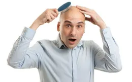 Hy vọng mới cho những người hói đầu