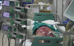 Một bệnh nhân mắc thủy đậu biến chứng đang nguy kịch